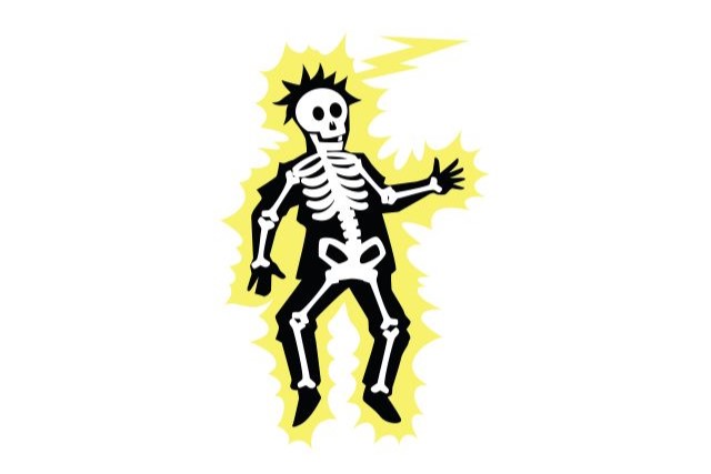 elektrický šok